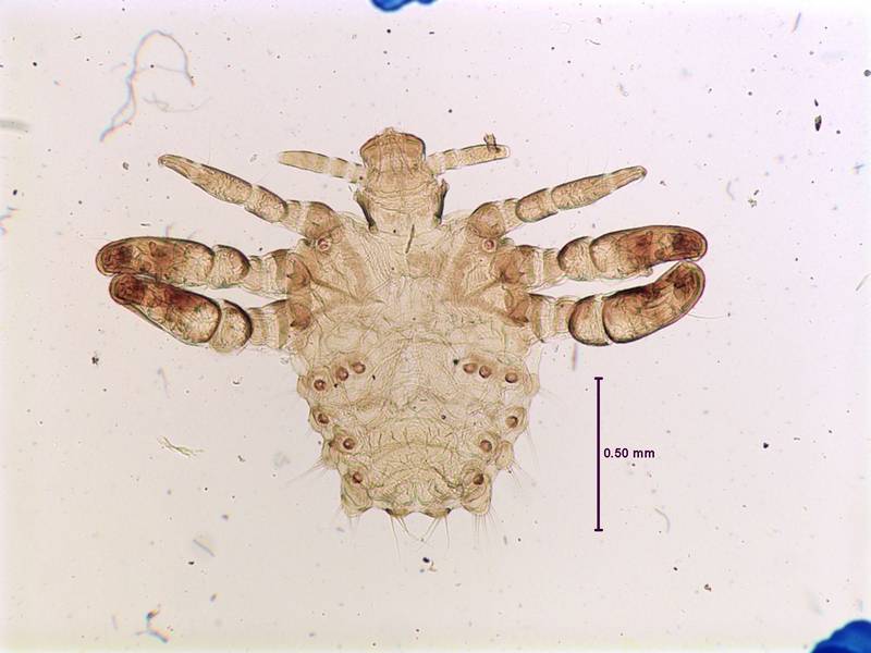 Лобковая вошь (площица) фото (лат. Pthirus pubis)